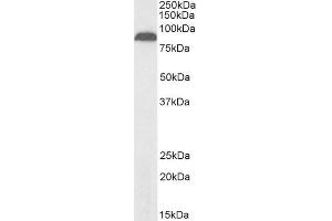 Biotinylated ABIN5539600 (2µg/ml) staining of Human Pancreas lysate (35µg protein in RIPA buffer), exactly mirroring its parental non-biotinylated product. (TRPV5 antibody  (Internal Region) (Biotin))