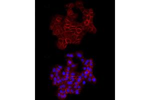 Immunofluorescence analysis of A-431 cells using E-Cadherin Rabbit pAb  at dilution of 1:100 (40x lens). (E-cadherin antibody  (AA 700-800))