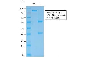 SDS-PAGE Analysis of Purified BCL2 Mouse Recombinant Monoclonal Antibody ABIN6383841. (Recombinant Bcl-2 antibody)