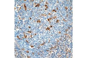 Immunohistochemistry (IHC) image for anti-Vimentin (VIM) (AA 325-375) antibody (ABIN7449539)
