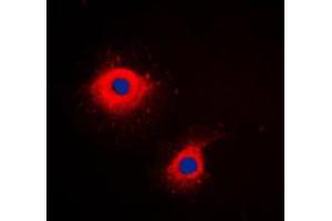 Immunofluorescent analysis of Cytokeratin 7 staining in HeLa cells.