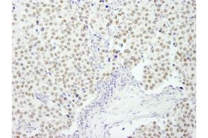 Immunohistochemistry (IHC) image for anti-REST Corepressor 3 (RCOR3) (AA 445-495) antibody (ABIN7449047) (RCOR3 antibody  (AA 445-495))
