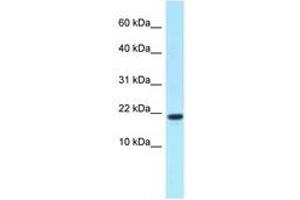 Image no. 1 for anti-X Antigen Family, Member 1D (XAGE1D) (C-Term) antibody (ABIN6747882) (XAGE1D antibody  (C-Term))