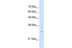 Tetraspanin 32 antibody used at 2. (TSPAN32 antibody  (Middle Region))