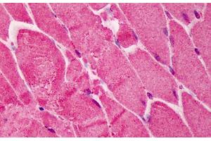 Human Skeletal Muscle: Formalin-Fixed, Paraffin-Embedded (FFPE) (RNF2 antibody  (AA 189-201))