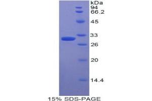 SDS-PAGE analysis of Human Myosin IE Protein. (MYO1E Protein)