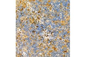 Immunohistochemistry (Paraffin-embedded Sections) (IHC (p)) image for anti-HLA-DR-gamma (CD74) antibody (ABIN7074245)