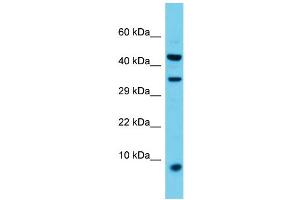 Host: Rabbit  Target Name: Vamp8  Sample Tissue: Rat Spleen lysates  Antibody Dilution: 1. (VAMP8 antibody  (Middle Region))