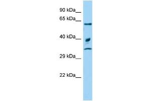 Host: Rabbit Target Name: Arih2 Sample Type: Rat Testis lysates Antibody Dilution: 1.