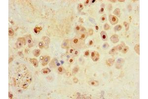 Immunohistochemistry of paraffin-embedded human placenta tissue using ABIN7176688 at dilution of 1:100 (SLC3A8 (AA 320-369) antibody)