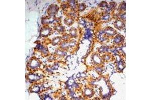 Immunohistochemical analysis of Beta-actin staining in human ovary formalin fixed paraffin embedded tissue section.