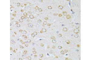 Immunohistochemistry of paraffin-embedded Mouse brain using NTS Polyclonal Antibody at dilution of 1:100 (40x lens). (Neurotensin antibody)
