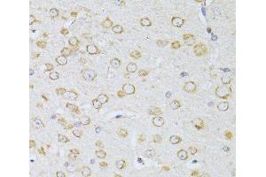 Immunohistochemistry of paraffin-embedded Mouse brain using NTS Polyclonal Antibody at dilution of 1:100 (40x lens).