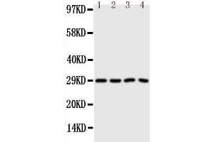 Anti-Carbonic Anhydrase III antibody, Western blotting Lane 1: SMMC Cell Lysate Lane 2: HELA Cell Lysate Lane 3: SW620 Cell Lysate Lane 4: SCG Cell Lysate (CA3 antibody  (N-Term))