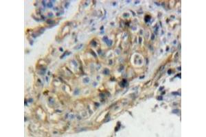 #VALUE! (TPBG antibody  (AA 34-356))