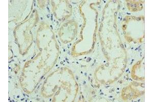 Immunohistochemistry of paraffin-embedded human kidney tissue using ABIN7176712 at dilution of 1:100 (SLC39A6 antibody  (AA 170-320))