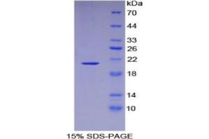 SDS-PAGE analysis of Mouse Aconitase 1 Protein. (Aconitase 1 Protein (ACO1))
