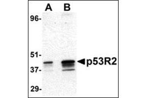 Western blot analysis of p53R2 expression in A431 cell lysate with this product at (A) 0. (RRM2B antibody  (N-Term))