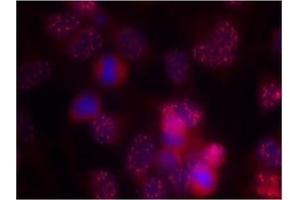 Image no. 2 for anti-Protein Kinase C, delta (PKCd) (AA 643-647) antibody (ABIN197564) (PKC delta antibody  (AA 643-647))
