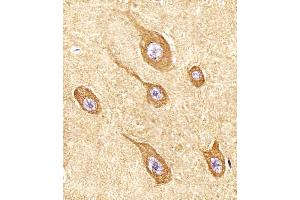 Immunohistochemistry (IHC) image for anti-Stathmin-Like 2 (STMN2) (AA 82-116) antibody (ABIN6243304)