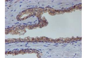 Image no. 1 for anti-Estrogen Receptor 1 (ESR1) antibody (ABIN1498060) (Estrogen Receptor alpha antibody)