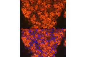 Immunofluorescence (IF) image for anti-Chymotrypsin (CTRL) antibody (ABIN7266395)