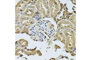 Immunohistochemistry of paraffin-embedded rat kidney using CDH6 antibody (ABIN5974784) at dilution of 1/100 (40x lens). (CDH6 antibody)