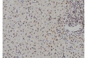 ABIN6273567 at 1/100 staining Human liver tissue by IHC-P. (ZNF709 antibody  (N-Term))