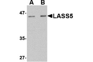 Western Blotting (WB) image for anti-LAG1 Homolog, Ceramide Synthase 5 (LASS5) (N-Term) antibody (ABIN1031436) (LASS5 antibody  (N-Term))