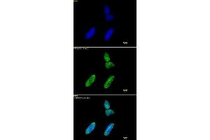 Histone H3 acetyl Lys9 antibody tested by immunofluorescence. (Histone 3 antibody  (H3K9ac))
