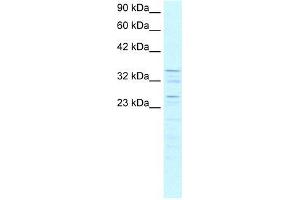Human K562; WB Suggested Anti-ZNF385 Antibody Titration: 0. (ZNF385A antibody  (C-Term))