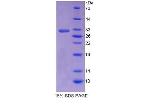 SDS-PAGE analysis of Human SHP Protein. (NR0B2 Protein)