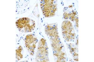 Immunohistochemistry of paraffin-embedded human stomach using C8orf4 antibody (ABIN5975014) at dilution of 1/100 (40x lens). (C8orf4 antibody)
