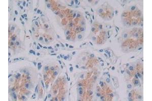 Detection of GDF6 in Human Stomach Tissue using Polyclonal Antibody to Growth Differentiation Factor 6 (GDF6) (GDF6 antibody  (AA 336-455))