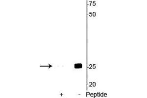 Western blot of mouse heart lysate showing specific immunolabeling of the ~25 kDa cardiac troponin I protein phosphorylated at Ser23/24 in the second lane (-). (TNNI3 antibody  (pSer23, pSer24))