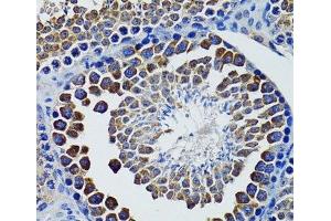 Immunohistochemistry of paraffin-embedded Rat testis using HEXA Polyclonal Antibody at dilution of 1:100 (40x lens). (Hexosaminidase A antibody)