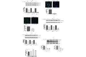 Immunofluorescence (IF) image for anti-COL1A2/COL1A1 antibody (ABIN5596819)