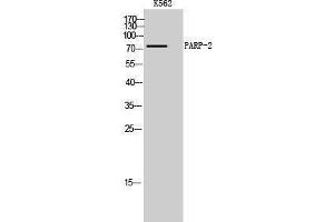 Western Blotting (WB) image for anti-Poly (ADP-Ribose) Polymerase 2 (PARP2) (Internal Region) antibody (ABIN3186334) (PARP2 antibody  (Internal Region))