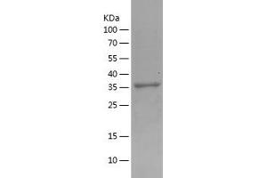 Western Blotting (WB) image for Acetyl-CoA Acetyltransferase 1 (ACAT1) (AA 34-187) protein (His-IF2DI Tag) (ABIN7282041) (ACAT1 Protein (AA 34-187) (His-IF2DI Tag))