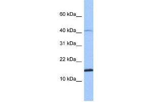 SPAG11B antibody used at 1 ug/ml to detect target protein.