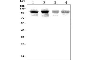 Western blot analysis of PLD2 using anti-PLD2 antibody (ABIN7601520).