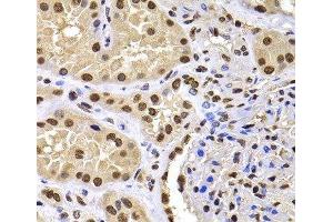 Immunohistochemistry (Paraffin-embedded Sections) (IHC (p)) image for anti-HIRA Interacting Protein 3 (HIRIP3) antibody (ABIN7262957)