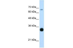 WB Suggested Anti-THOC3 Antibody Titration:  0. (THO Complex 3 antibody  (Middle Region))