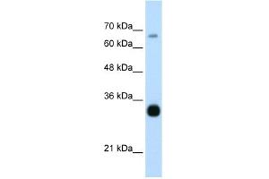 WB Suggested Anti-THOC3 Antibody Titration:  0.