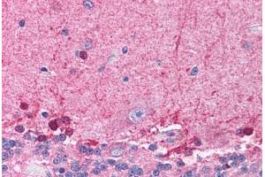 Human Brain, Cerebellum (formalin-fixed, paraffin-embedded) stained with HDAC8 antibody ABIN214773 at 5 ug/ml followed by biotinylated goat anti-rabbit IgG secondary antibody ABIN481713, alkaline phosphatase-streptavidin and chromogen. (HDAC8 antibody  (C-Term))