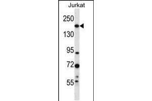 Western blot analysis in Jurkat cell line lysates (35ug/lane). (UGGT1 antibody  (C-Term))