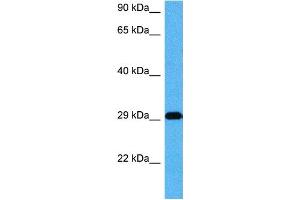 Host:  Mouse  Target Name:  CDX2  Sample Tissue:  Mouse Skeletal Muscle  Antibody Dilution:  1ug/ml (CDX2 antibody  (Middle Region))