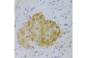 Immunohistochemistry of paraffin-embedded human rectum using PA2G4 Antibody (ABIN5973112) at dilution of 1/100 (40x lens). (PA2G4 antibody)