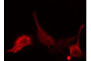 ABIN6274769 staining LOVO cells by IF/ICC. (RPL15 antibody  (C-Term))