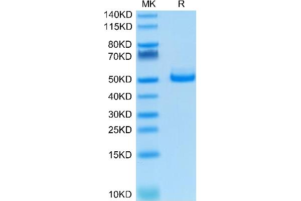 TIGIT Protein (AA 22-141) (Fc Tag)